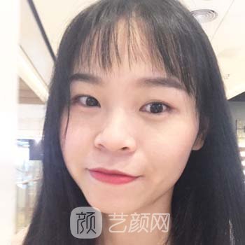 安阳市人民医院整形美容科怎么样？医生介绍+光子嫩肤实例