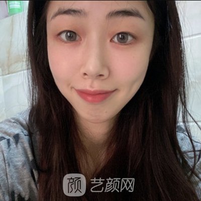 东莞美立方美容医院做鼻子怎样?医院招牌实例出炉