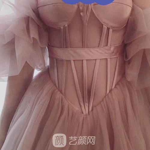 上海臻妮医疗美容医院吸脂靠谱么？全新体验实例展示