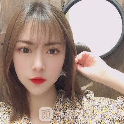 倪云志做鼻子实例展示|成果自然无痕