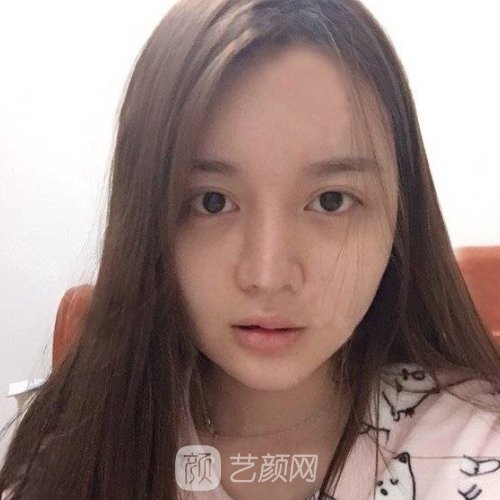 北京八大处唇裂修复怎么样?医院全新体验实例公开