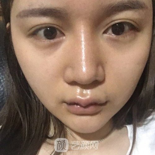 北京八大处唇裂修复怎么样?医院全新体验实例公开
