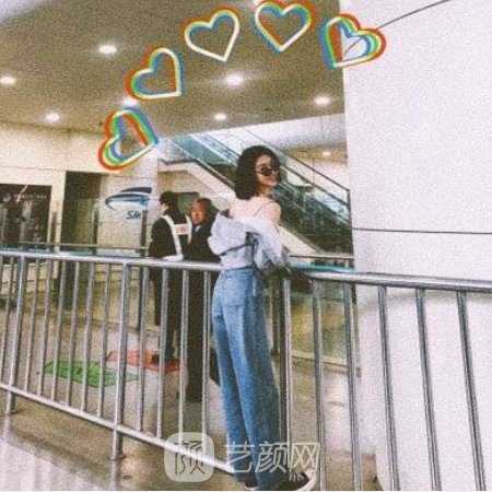 广州美莱大腿抽脂成果图展示|成果自然美观