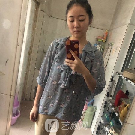 宁波二院私密整形科怎么样?全新阴道紧缩实例公开