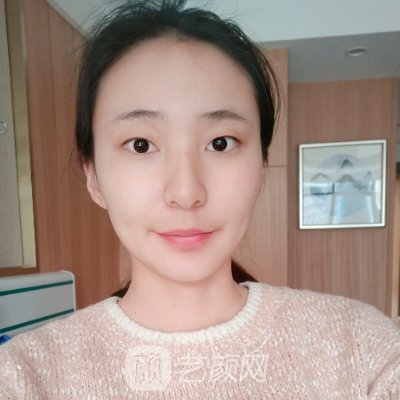 重庆华美杨丽萍做眼睛怎么样?2022全新实例一览