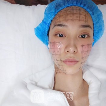 华山医院热玛吉怎么样？价格多少钱？附热玛吉除皱实例