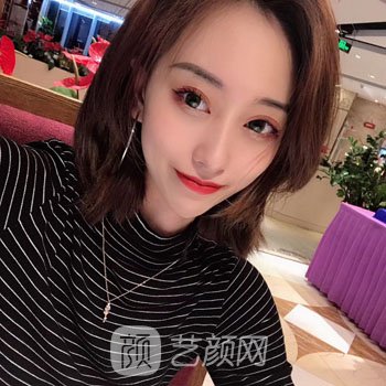 华山医院热玛吉怎么样？价格多少钱？附热玛吉除皱实例