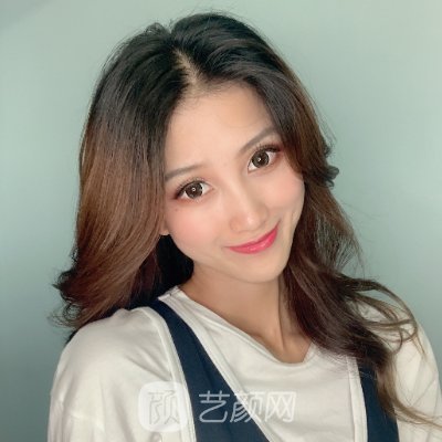 南昌韩美美容医院隆鼻实例出炉|80天体验细节图展示