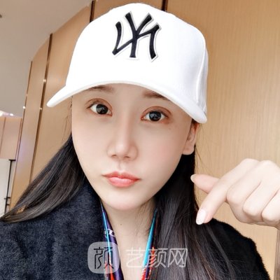 长春美奇国际整形医院双眼皮怎么样？2022体验实例曝光