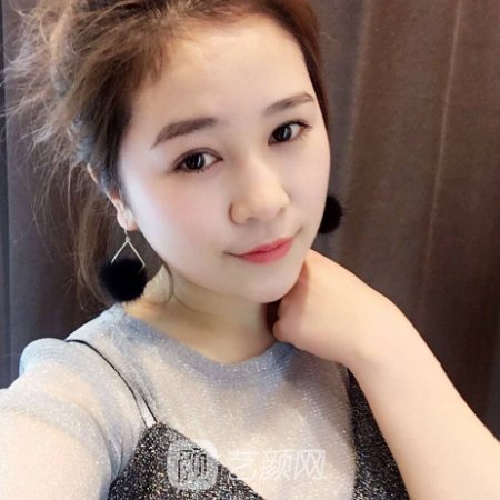 广州南方医院整形科眼综合整形实例公开|附体验成果图