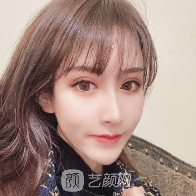 嘉兴曙光美容医院隆鼻实例出炉|80天体验成果图出炉