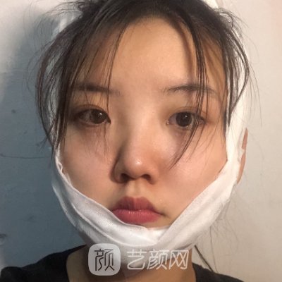 上海港华医院磨骨靠谱吗？医院实力及实例曝光
