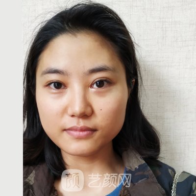 福州美贝尔林建华隆鼻正规吗?医生实力及实例分享