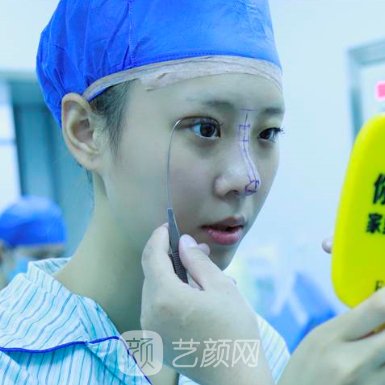 西安画美杨万忠做鼻子怎么样?2023招牌实例公开