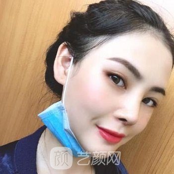 沈干隆鼻失败修复实例，修复好了丑陋的鼻子，仿佛如获新生~