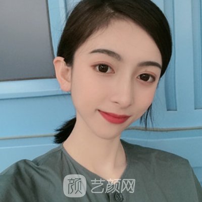 长沙美莱植发靠谱吗？｜全新发际线种植实例公开