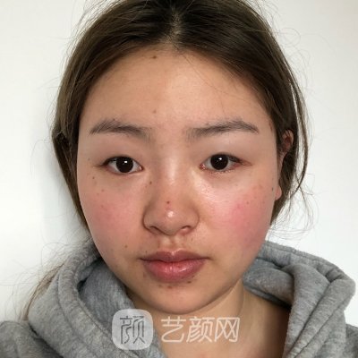 南京施尔美刘卫做鼻子怎么样？医生实力及实例曝光