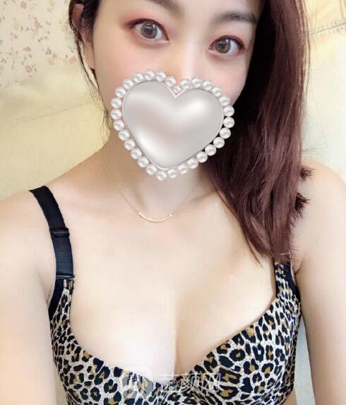 北京隆胸刘春军实例视频，术后变成凹凸有致的大胸美女~