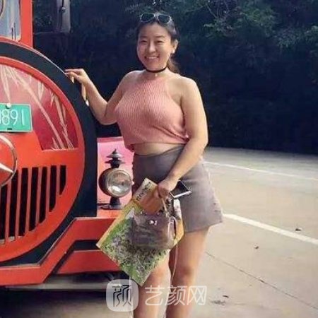 贵阳美贝尔谭林医生吸脂技术怎么样?真人体验过程图一览