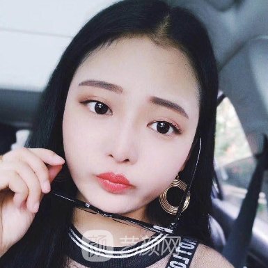 南昌爱美余志亮做鼻子技术怎么样?医生实力及实例一览
