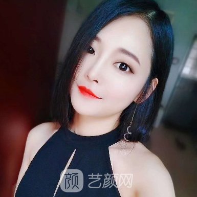 南昌爱美余志亮做鼻子技术怎么样?医生实力及实例一览