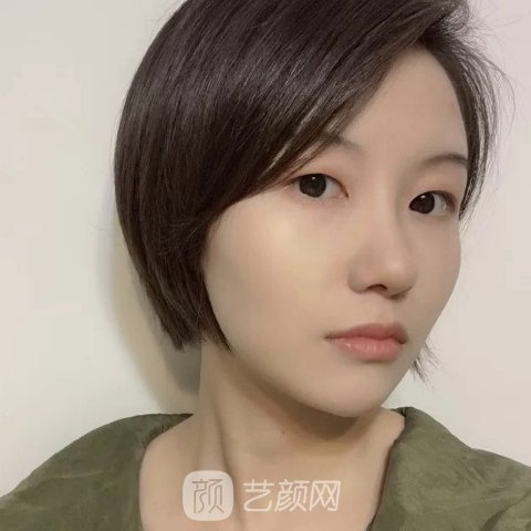 石家庄美莱整形医院做注射除皱怎么样?全新体验实例公布