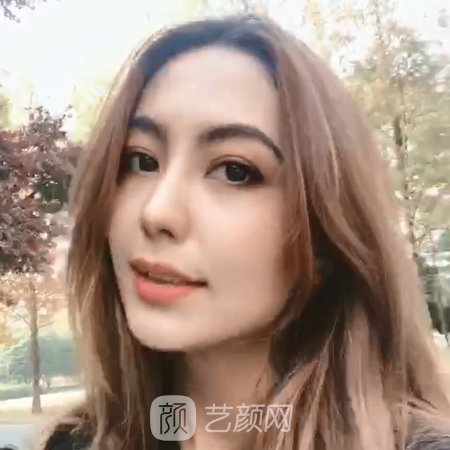 南京韩辰美容医院面部提升技术怎么样?医院招牌实例分享