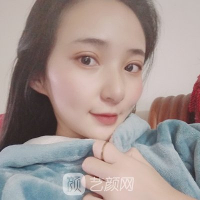 成都友谊整形医院做双眼皮怎么样?医院招牌实例展示