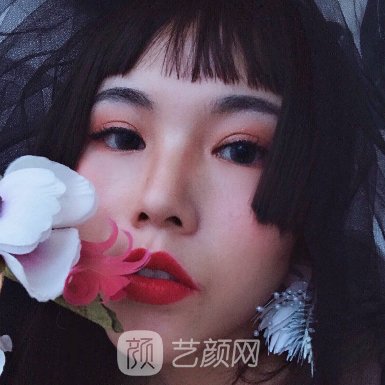 广州越秀紫馨曹仁昌医生割双眼皮怎么样?新版体验实例公开