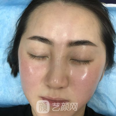 四川美莱美容整形医院除皱紧肤口碑怎么样?医院招牌实例公开