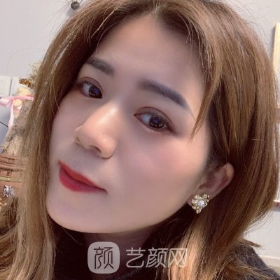 杭州连天美医疗美容医院割双眼皮怎么样?2023实例公开