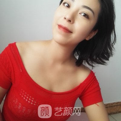 成都美容整形医院隆胸实例展示|附体验对比图