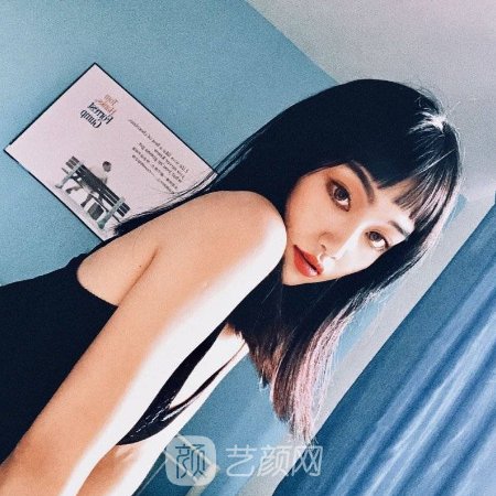 武汉正璞瘢痕整复医院疤痕修复实例展示|附体验成果图