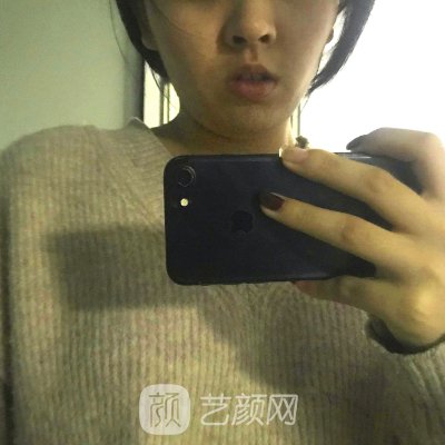 太原时光整形医院隆胸实例出炉|内含体验成果图