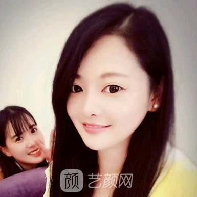 武汉华美整形美容医院隆鼻实例出炉|成果自然美观