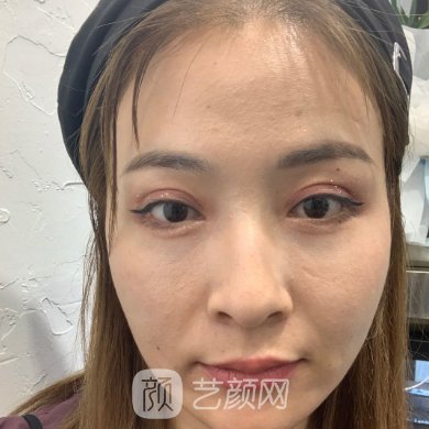 齐齐哈尔君悦医疗美容医院正规吗?2023除皱抗衰实例发布