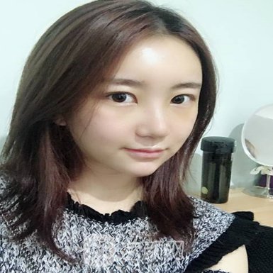 长沙一雅医疗美容医院正规吗?2023隆鼻实例分享