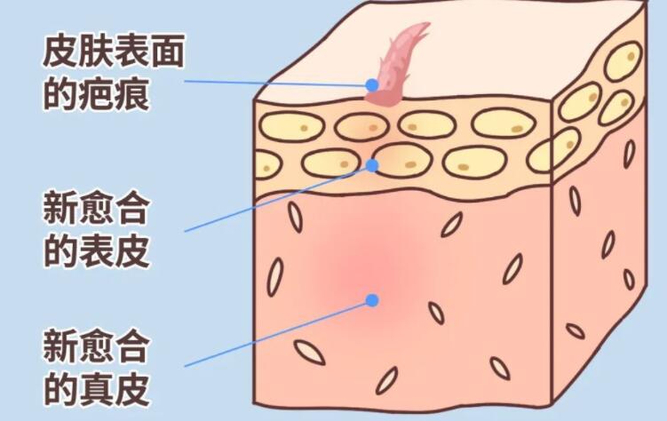 疤痕动漫01.jpg