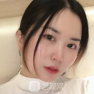 北京南加整形医院正规吗?2023注射除皱实例分享