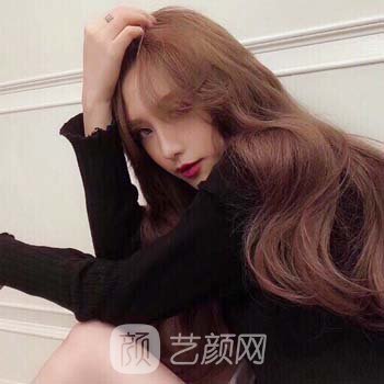 沈阳医大一院黄威隆鼻实例，完全看不出手术痕迹，就像天生的鼻子一样