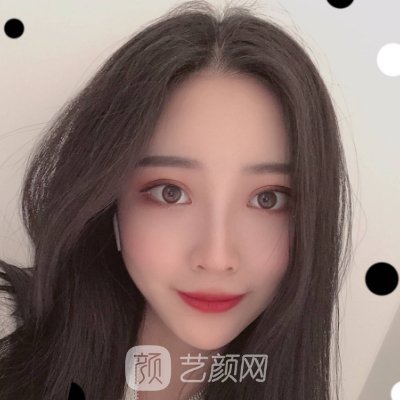 赣州韩美整形美容医院口碑怎么样?2023玻尿酸除皱实例分享