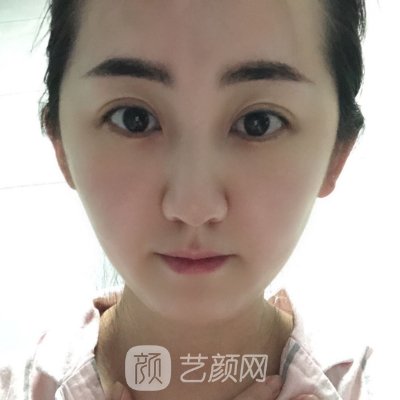 西安施尔绮整形医院正规吗?新版光子嫩肤实例一览