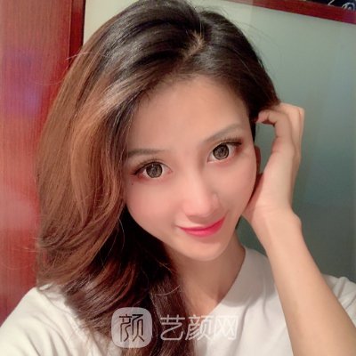 杭州格莱美医院隆鼻靠谱吗?2023体验实例一览