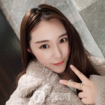 亳州缔莱美整形医院做双眼皮怎么样?2023体验实例出炉