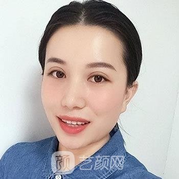 协和医院杨杰双眼皮做的好不好？医生简介+双眼皮实例对比图