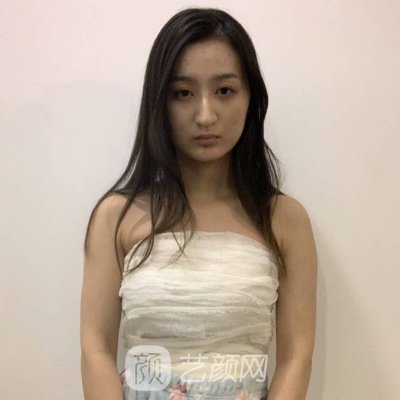苏州爱思特脂肪隆胸实例展示|附体验成果图