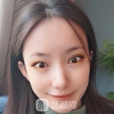 大连艾加艾整形是正规医院吗？新版光子嫩肤实例一览