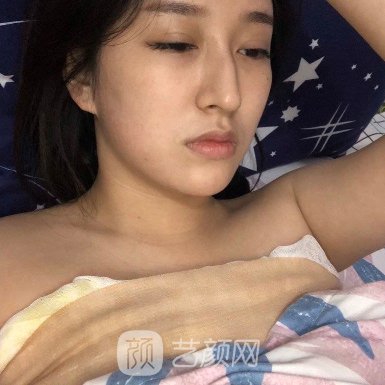 泉州美莱华美医疗美容正规吗?2023隆胸实例一览