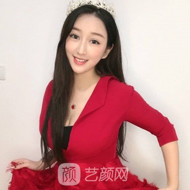 泉州美莱华美医疗美容正规吗?2023隆胸实例一览