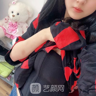 上海千美整形医院吸脂成果怎么样?全新体验实例展示